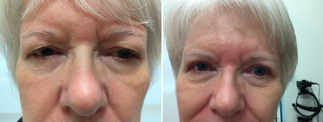 Before & After 1
