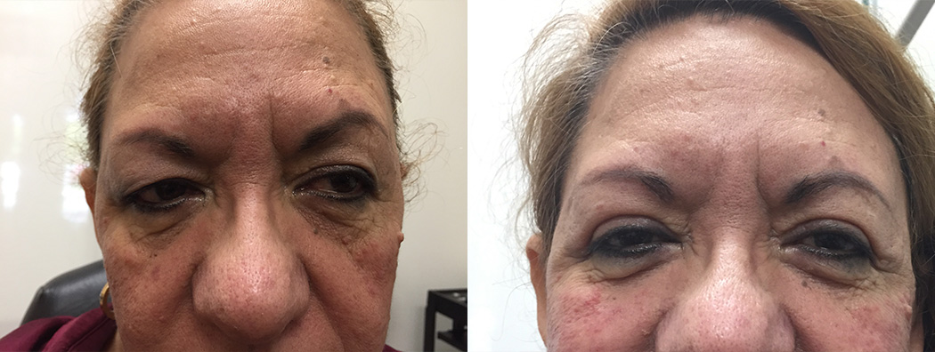 Before & After 2