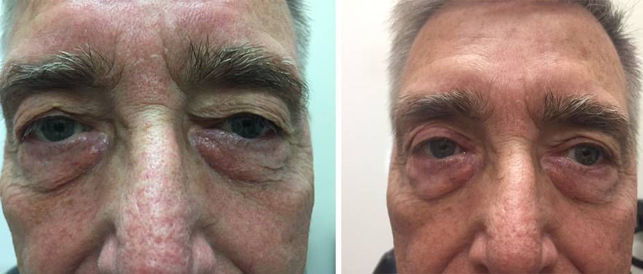 Before & After 5