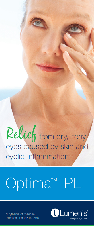 Optima IPL Treatment